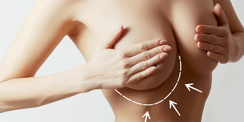 Breast Augmentation Istanbul
