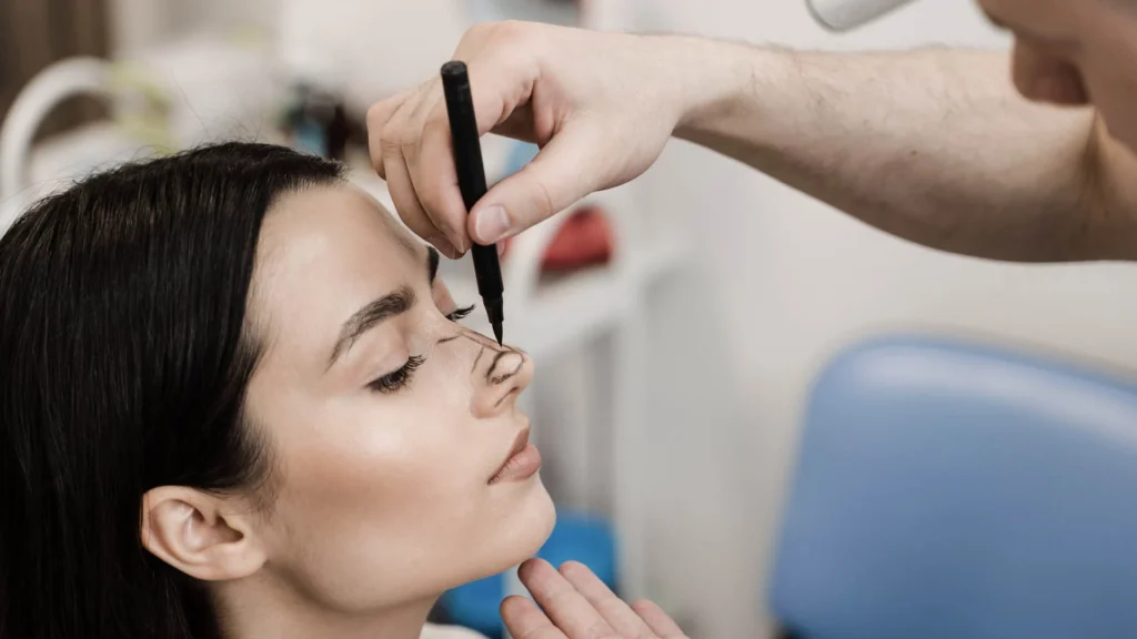 Rhinoplasty surgery in Istanbul, using advanced techniques to reshape and refine the nose, improving both aesthetics and function for a natural, balanced facial appearance.