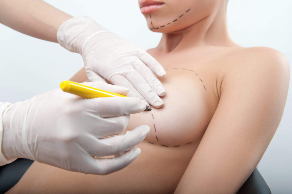 Natural breast augmentation using fat transfer for a fuller and natural-looking breast enhancement.