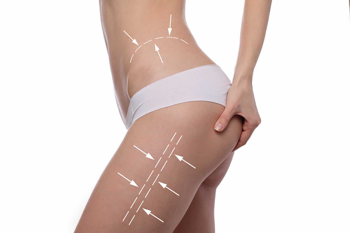 Thigh Lift Surgery: Redefine your legs with advanced cosmetic techniques at Cmeday Beauty in Istanbul.
